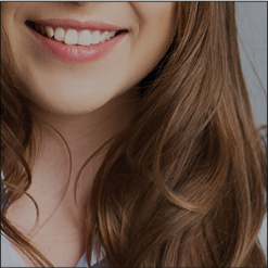 teeth-whitening-for-wedding-in-marbella-banner-s